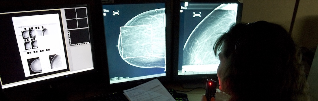 mammography