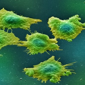 colon cancer cells