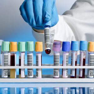 medical samples